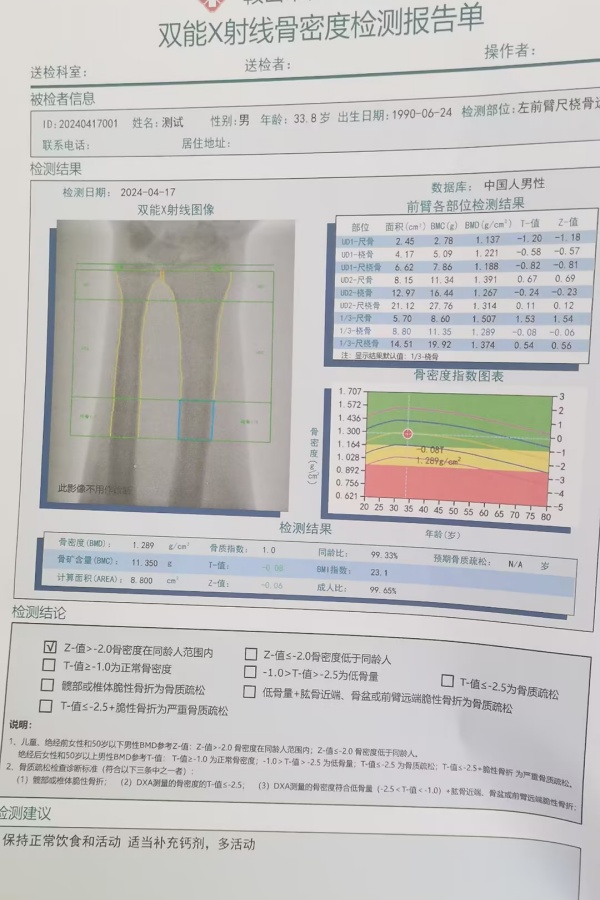 雙能X射線骨密度儀：準確測量骨密度，助力骨質(zhì)疏松防治，守護骨骼健康